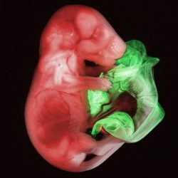 3-foster-moderkage_jpg